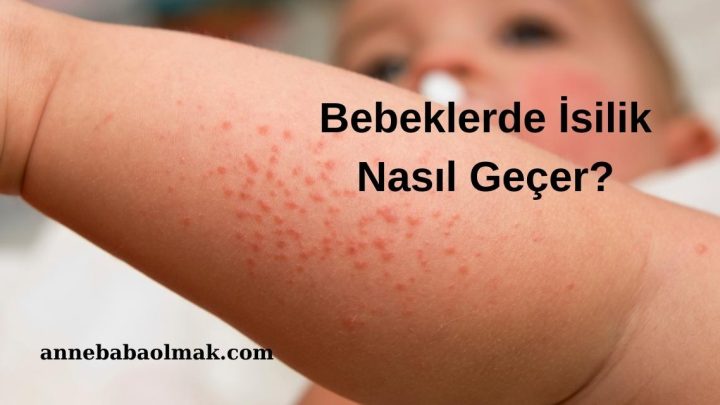 Bebeklerde İsilik Nasıl Geçer?